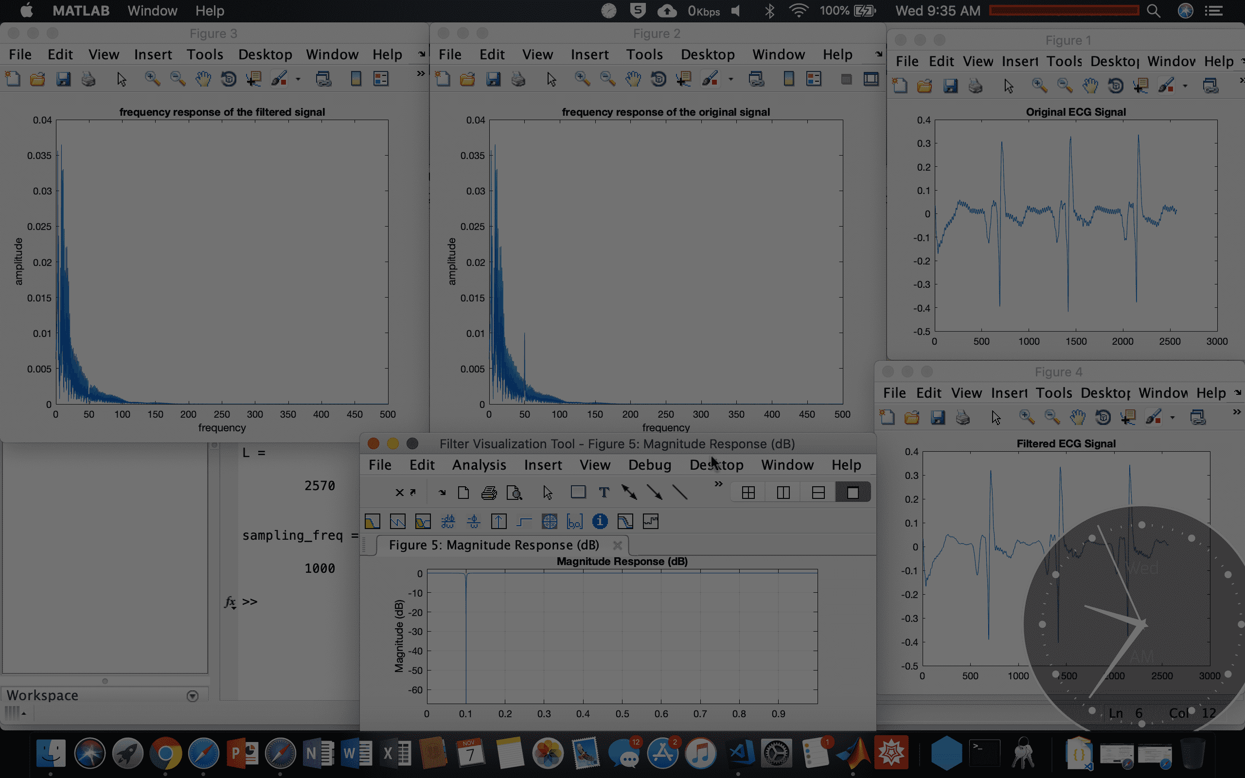 Notch Filter to remove noise from an ECG Signal